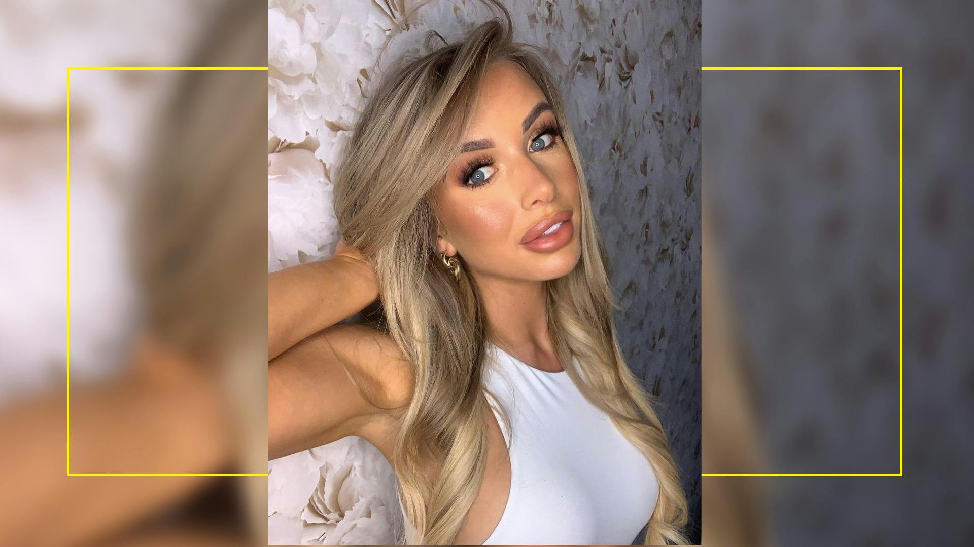 Love Island’s Faye Winter Reveals Her Newly Dissolved Lip Fillers And Explains All Grazia